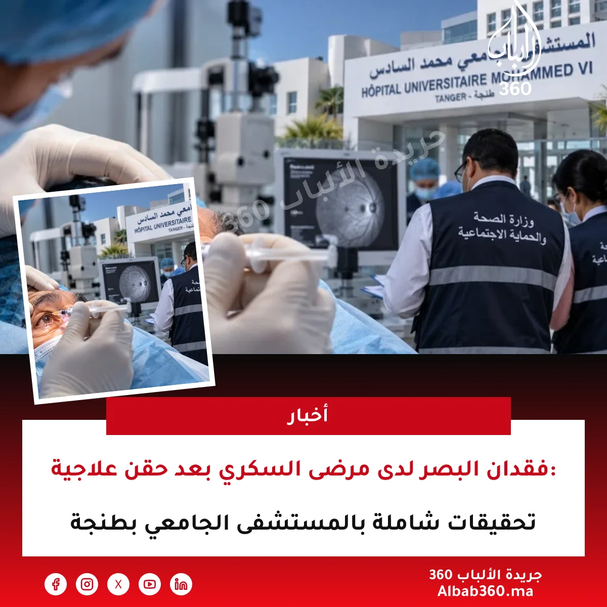 فقدان البصر لدى مرضى السكري بعد حقن علاجية: تحقيقات شاملة بالمستشفى الجامعي بطنجة
