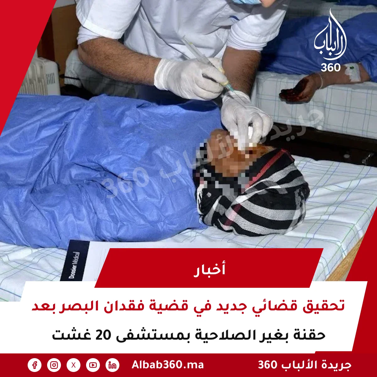 تحقيق قضائي جديد في قضية فقدان البصر بعد حقنة بغير الصلاحية بمستشفى 20 غشت